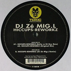 DJ Ze Mig L - Hiccups-Reworkz