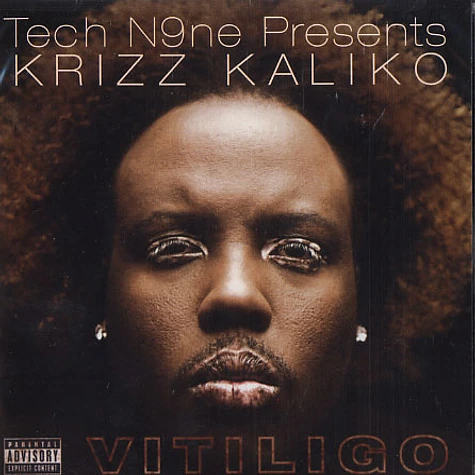Tech N9ne presents Krizz Kaliko - Vitiligo