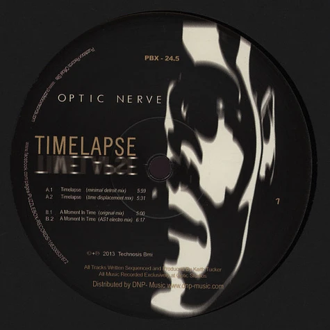 Optic Nerve - Time Lapse