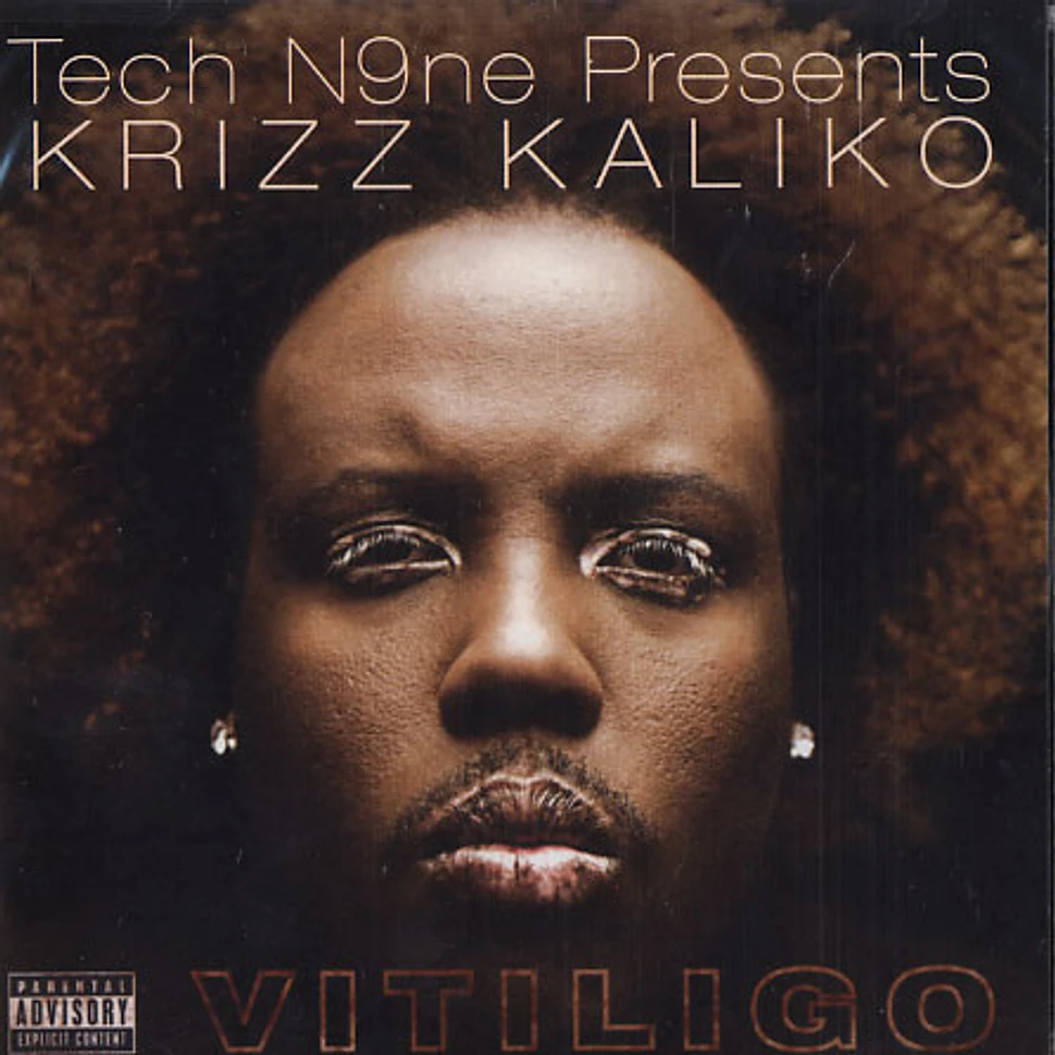 Tech N9ne presents Krizz Kaliko - Vitiligo