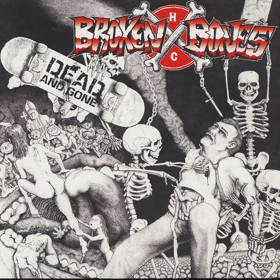 Broken Bones - Dead And Gone