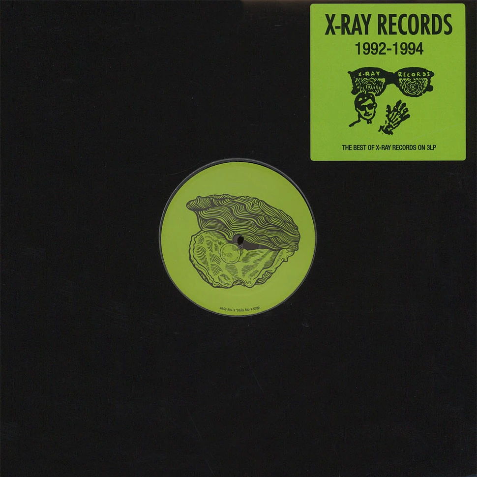 Raymond Castoldi - X-Ray Records 1992-1994